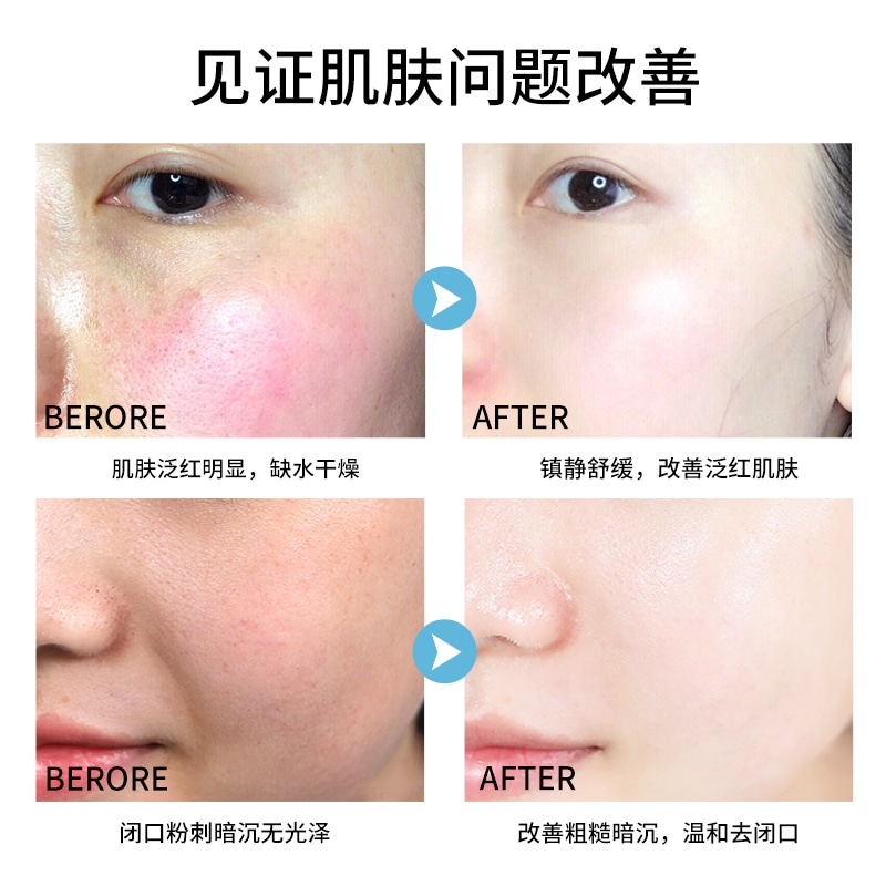 GALANDUTIN/嘉兰杜汀 (Арт. 舒缓保湿爽肤水100ml+舒缓保湿乳液80ml套组) — фото 10